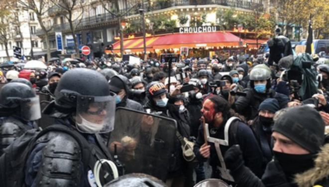 Un musicien blessé au visage après une charge à l'aveugle. © AR Un musicien blessé au visage après une charge à l'aveugle. © AR
