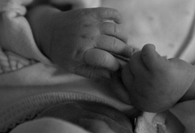carys-anencephaly