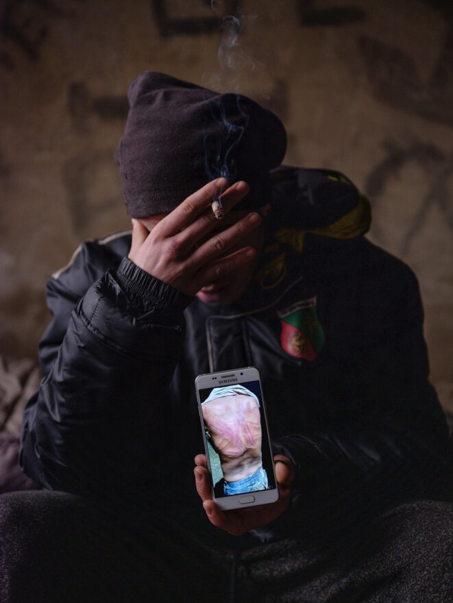 Velika Kladusa, Bosnie, décembre 2020. Les migrants partagent entre eux les photos, prises par les ONG qui leur viennent en aide, des violences subies lors des passages à tabac par les forces croates. © Ljubisa Danilovic/Tendance Floue Velika Kladusa, Bosnie, décembre 2020. Les migrants partagent entre eux les photos, prises par les ONG qui leur viennent en aide, des violences subies lors des passages à tabac par les forces croates. © Ljubisa Danilovic/Tendance Floue