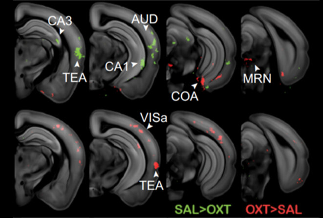 Scans de tranches de cerveau de souris montrant des différences dans les niveaux d'ocytocine Scans de tranches de cerveau de souris montrant des différences dans les niveaux d'ocytocine
