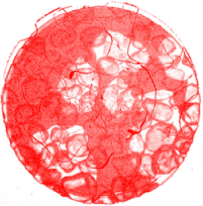 Atelier pour la refondation du service public hospitalier Marseille 23-24/01/21