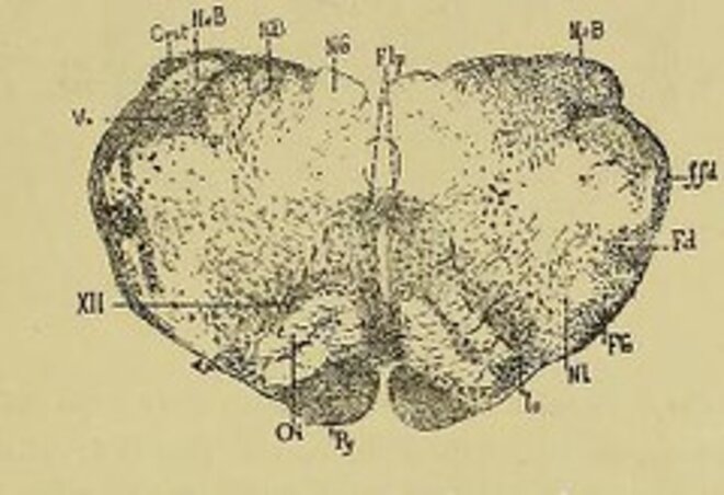 This image is taken from Page 63 of Le cervelet, Etude anatomique, clinique et physiologique" © Medical Heritage Library, Inc. This image is taken from Page 63 of Le cervelet, Etude anatomique, clinique et physiologique" © Medical Heritage Library, Inc.