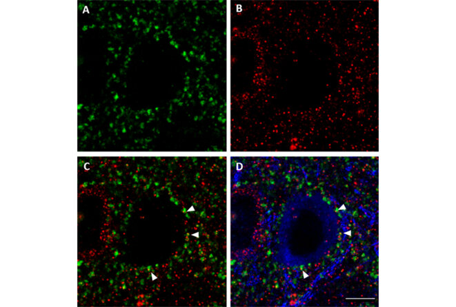 Conduite excitatrice : La structure des neurones inhibiteurs chez les souris auxquelles il manque une copie du gène SYNGAP1 est typique, mais les neurones ont des entrées excitatrices réduites (flèches blanches). © Spectrum News Conduite excitatrice : La structure des neurones inhibiteurs chez les souris auxquelles il manque une copie du gène SYNGAP1 est typique, mais les neurones ont des entrées excitatrices réduites (flèches blanches). © Spectrum News