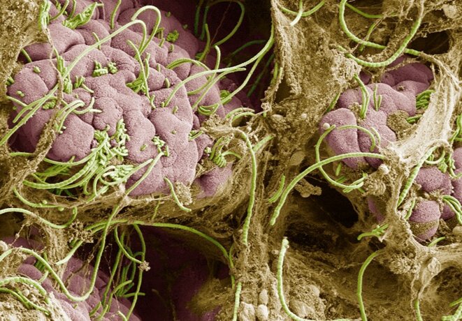 Des bactéries filamenteuses segmentées dans l'intestin (en vert) surstimulent le système immunitaire des souris gravides qui ont une infection, altérant le développement du cerveau du fœtus. © Dan Littman, Alice Liang, Doug Wei et Eric Roth Des bactéries filamenteuses segmentées dans l'intestin (en vert) surstimulent le système immunitaire des souris gravides qui ont une infection, altérant le développement du cerveau du fœtus. © Dan Littman, Alice Liang, Doug Wei et Eric Roth