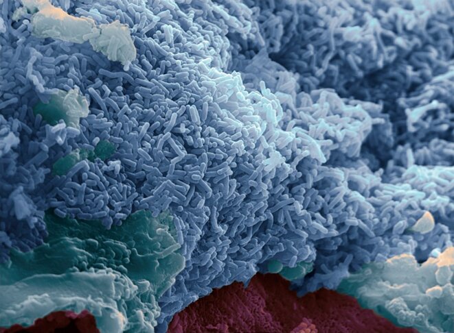 La bactérie intestinale Lactobacillus reuteri est testée comme traitement des symptômes des troubles du spectre autistique dans le cadre d'un petit essai. © Stephanie Schuller/Alistair Walsham/SPL La bactérie intestinale Lactobacillus reuteri est testée comme traitement des symptômes des troubles du spectre autistique dans le cadre d'un petit essai. © Stephanie Schuller/Alistair Walsham/SPL