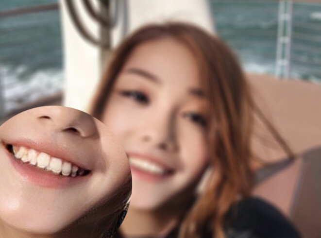 Le deepfake @azusagakuyuki montre quelques problèmes d’alignement avec le visage de Zonggu au niveau des dents. D’autres photo présentent des artefacts autour du cou, des cheveaux et une inconsistance entre différentes parties du corps (bras d’homme poilus et visage de jeune femme) Le deepfake @azusagakuyuki montre quelques problèmes d’alignement avec le visage de Zonggu au niveau des dents. D’autres photo présentent des artefacts autour du cou, des cheveaux et une inconsistance entre différentes parties du corps (bras d’homme poilus et visage de jeune femme)