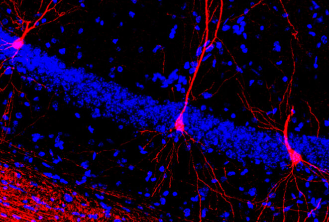 Test de natation : La localisation d'une plateforme sous-marine active des neurones spécifiques, marqués par un marqueur génétique (en rose), dans un modèle de souris du syndrome de Rett © .Avec l'aimable autorisation de Nathan Achilly Test de natation : La localisation d'une plateforme sous-marine active des neurones spécifiques, marqués par un marqueur génétique (en rose), dans un modèle de souris du syndrome de Rett © .Avec l'aimable autorisation de Nathan Achilly