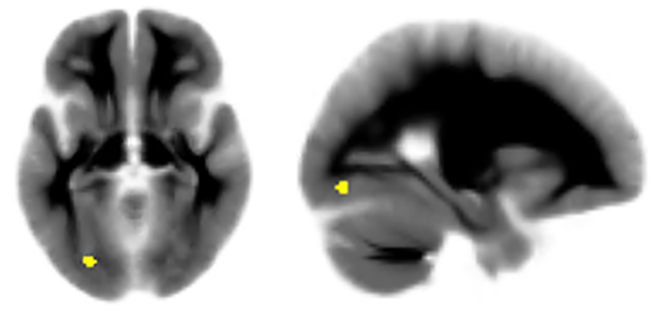 bhaa381f3-844