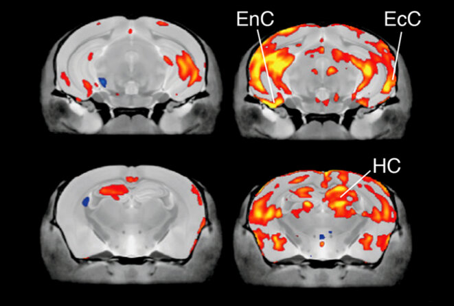 Effets de dose : Le cerveau des souris produisant seulement 35 % des niveaux typiques de protéine CHD8 (à droite) grossit dans plusieurs zones corticales, par rapport à celles produisant 50 % (à gauche). Effets de dose : Le cerveau des souris produisant seulement 35 % des niveaux typiques de protéine CHD8 (à droite) grossit dans plusieurs zones corticales, par rapport à celles produisant 50 % (à gauche).