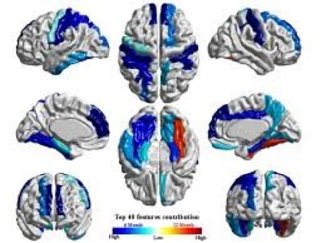Autisme et stand-up (2) : de quel spectre parle-t-on ?