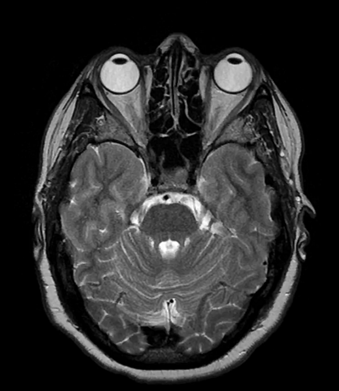 screenshot-2021-05-25-q-a-with-sebastien-jacquemont-and-clara-moreau-why-brain-imaging-signatures-for-autism-are-so-elusive