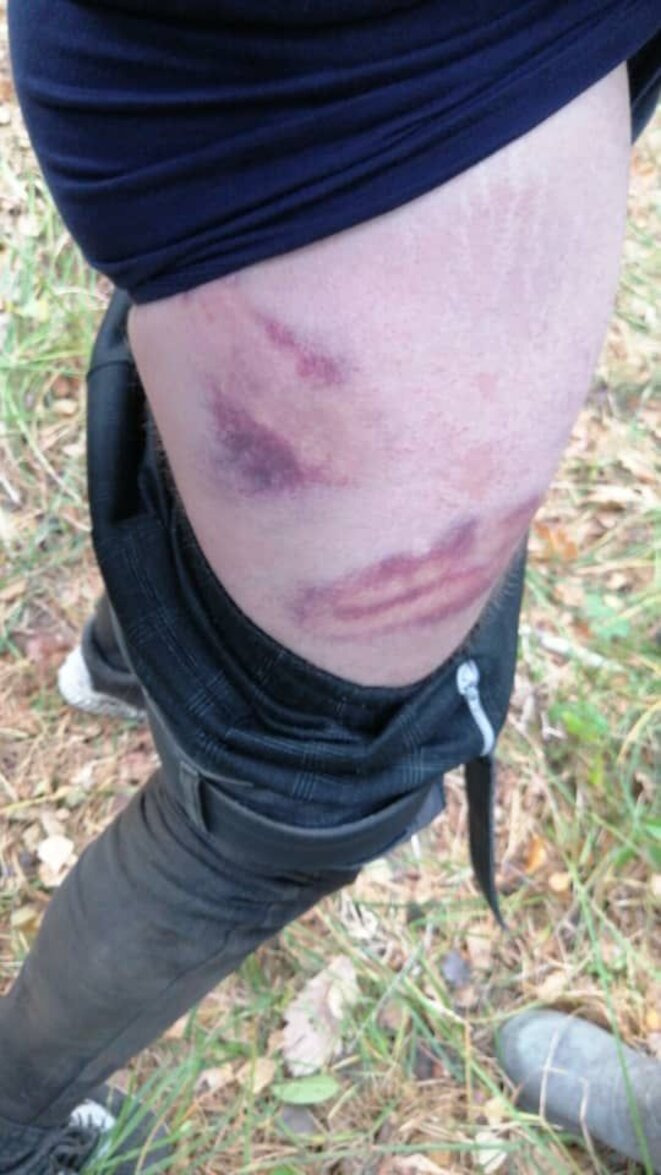 Une photo des blessures d’Ali. © DR