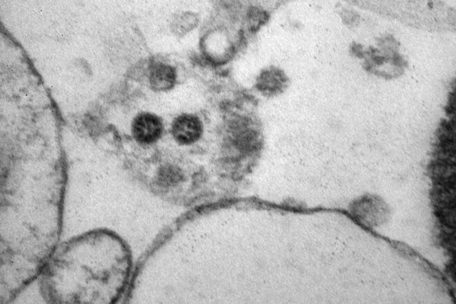 Des particules virales de la variante Omicron du Covid-19 au jour 6 après l'infection. © Photo Rospotrebnadzor / Spoutnik via AFP
