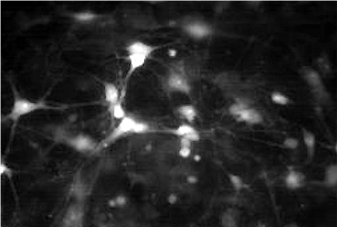 Autisme : Un seul gène ne suffit pas à expliquer les traits dup15q et Angelman