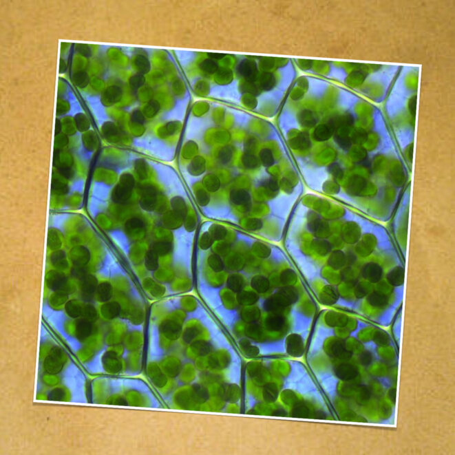 Pandémie métabolique : Chut ! Vérité qui dérange !