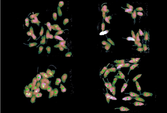 Etude multi-laboratoires et avantages d'un médicament de longue date pour l'autisme