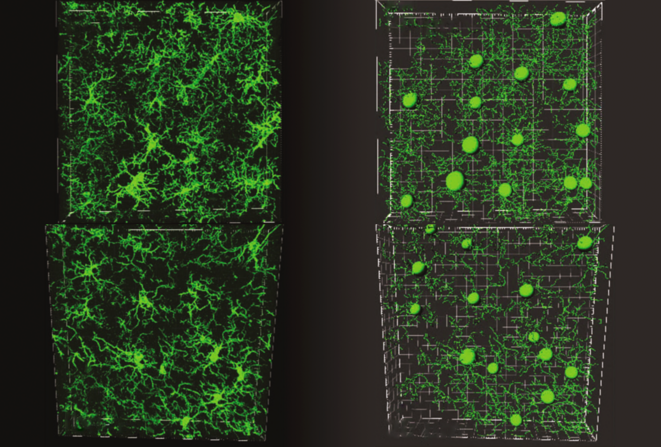 Sérotonine et élagage des circuits cérébraux en développement chez la souris