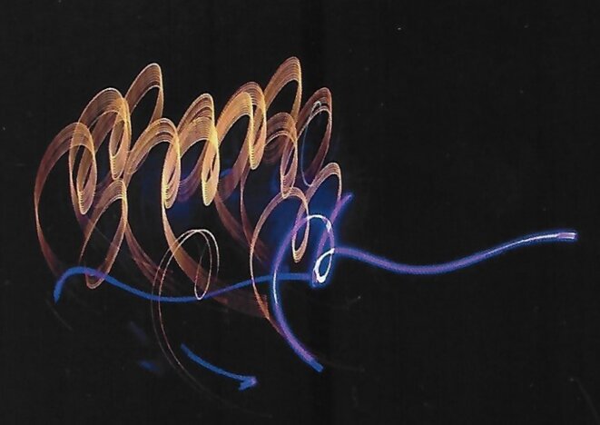 Une isoforme inconnue ajoute un élément à la théorie des origines de l'X fragile