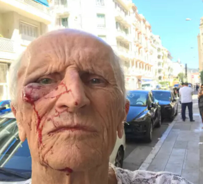 Mathieu B, l’agresseur du médecin de Mulhouse, a été libéré