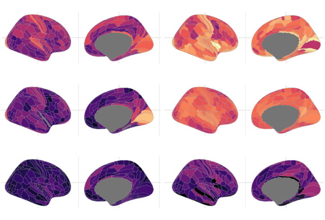 Des variantes génétiques communes façonnent la structure du cortex