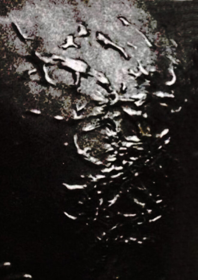 A ce tort que tu te fais