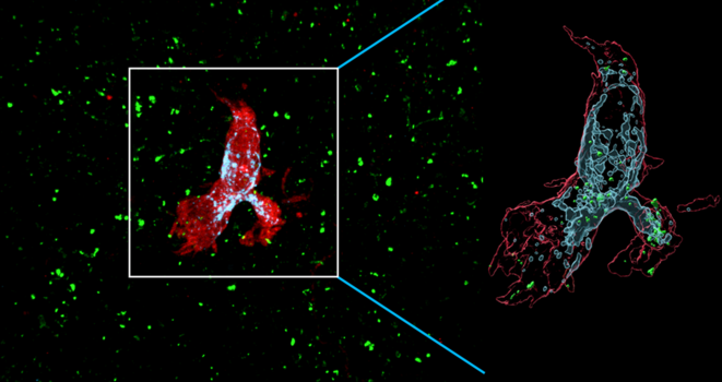 Réaction excessive de la microglie aux neurones atypiques et origine de l'autisme