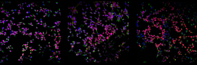 Perturbations liées à l'autisme, squelette cellulaire et protéines de liaison à l'ARN