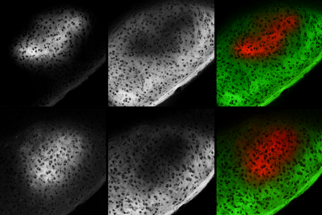La fonction d'élagage de la microglie remise en question