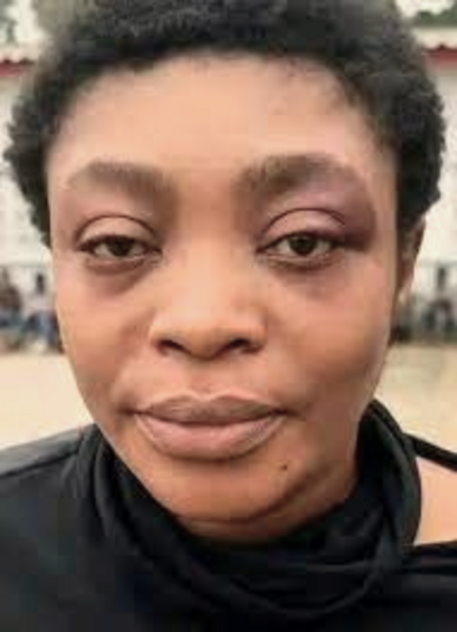 RDC - BRAQUAGE RAW BANK : L'affaire Honorine Porsche