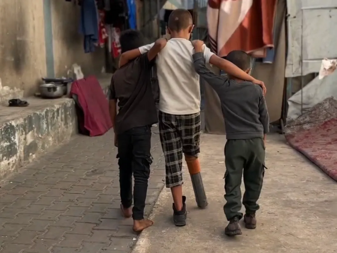 Blocus médical : les enfants amputés de Gaza condamnés aux prothèses de fortune