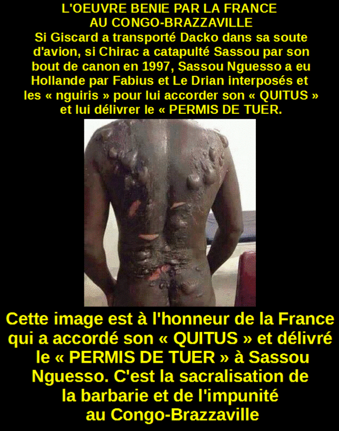 La suspension des helminthes chez les gens