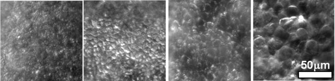 Vue des cellules dans chaque anneau © EPJ-E/VF/CNRS/MSC Vue des cellules dans chaque anneau © EPJ-E/VF/CNRS/MSC