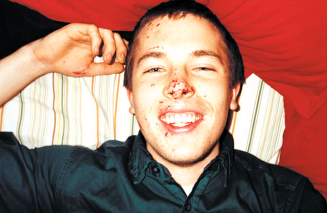RYAN (HEAD-BUTT), 1999, l'artiste venant de mettre un coup de tête à des homophobes dans la rue qui l'insultaient © Ryan McGinley RYAN (HEAD-BUTT), 1999, l'artiste venant de mettre un coup de tête à des homophobes dans la rue qui l'insultaient © Ryan McGinley