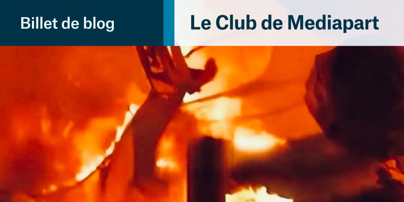 Image de génocide un Palestinien brûlé vif sur un lit d’hôpital par